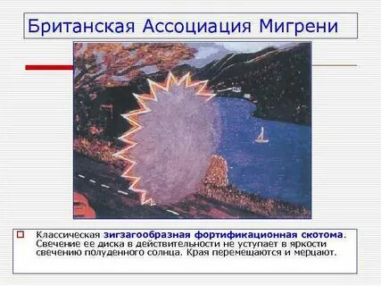 Причины мерцания