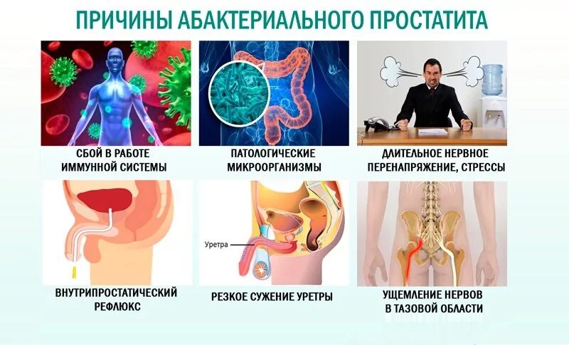 Абактериальный простатит. Хронический небактериальный простатит. Предпосылки простатита. Небактериальный простатит