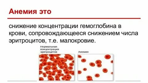 Что такое анемия простыми словами у ребенка