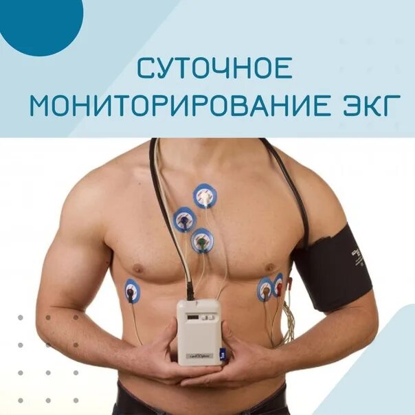 Мониторирование. Мониторирование
