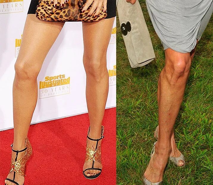 Ноги женщин выше колен. Красивые коленки. Женские колени. Худые некрасивые ноги. Некрасивые женские ноги.