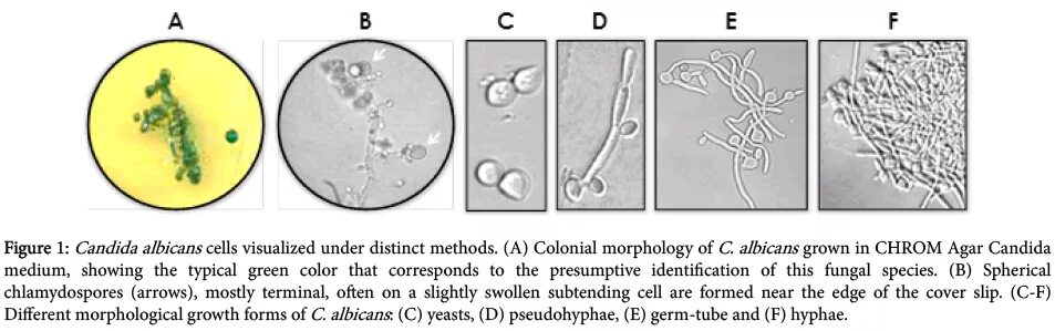 Candida igg. Candida альбиканс. Кандида альбиканс строение. Candida albicans хламидоспоры. Кандида альбиканс микробиология.