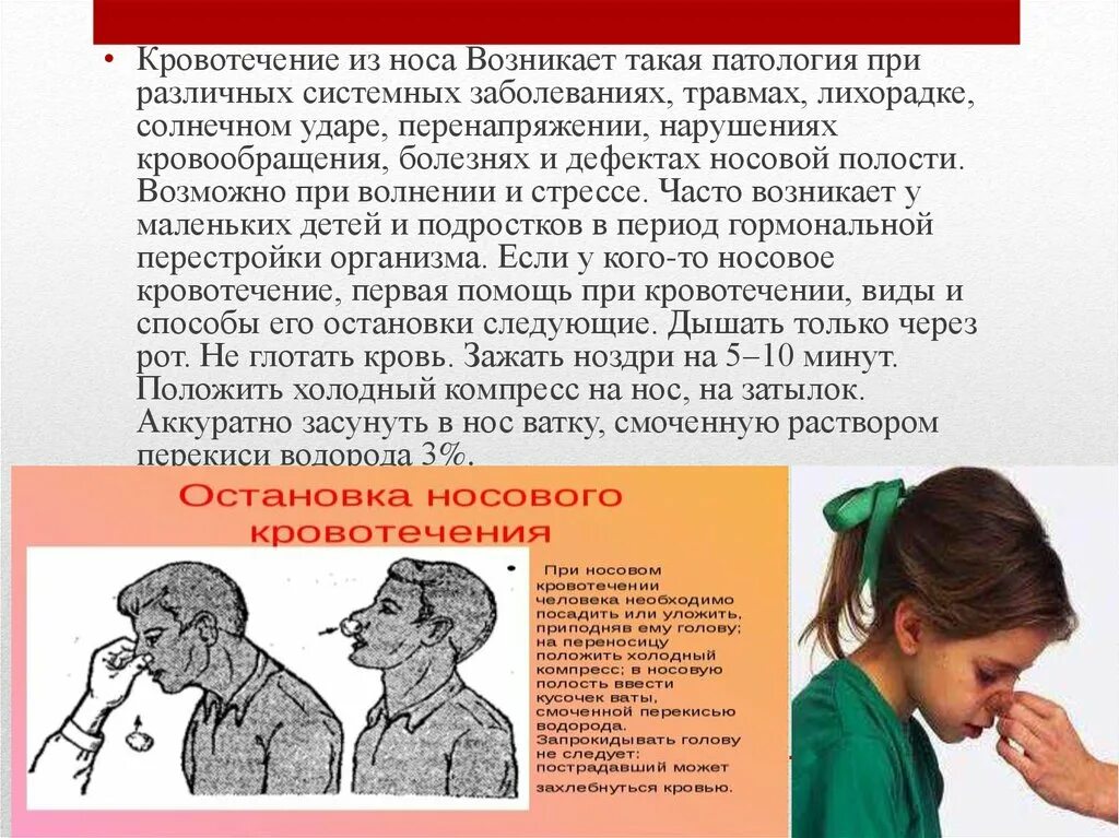 Почему часто идет. Причины кровотечения из носа. Рассказ путешествие капельки. Нососовое кровотечение. У ребенка идет кровь из носа.