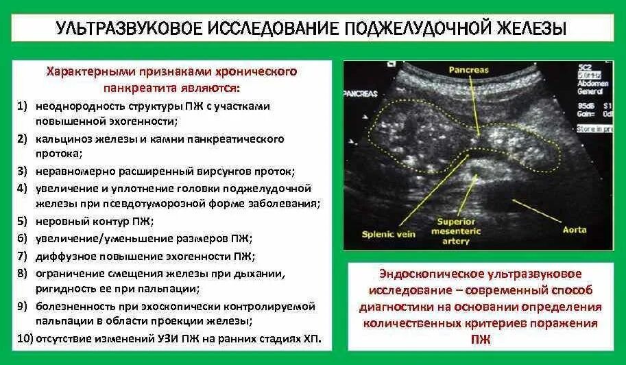 Диффузное увеличение поджелудочной. Норма УЗИ поджелудочной железы эхоструктура. УЗИ диагностика поджелудочной железы болезни. Хронический панкреатит УЗИ изменения. Подготовка пациента Киузи поджелудочной железы.