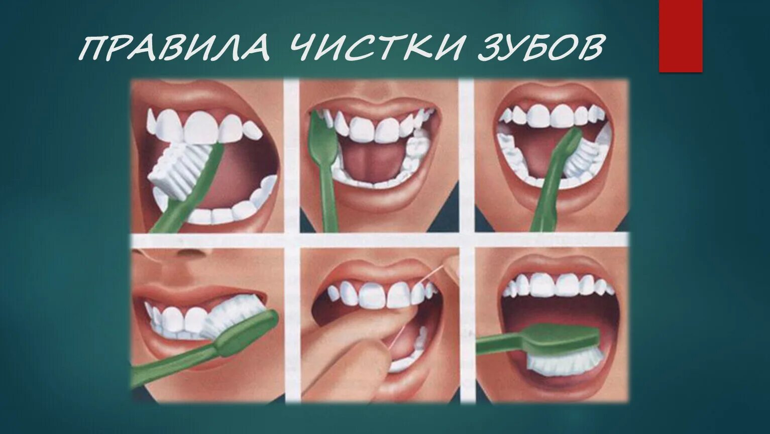 Уход за гигиеной полости рта. Правила чистки зубов. Правильная техника чистки зубов. Последовательность чистки зубов в картинках. Алгоритм чистки зубов для дошкольников.