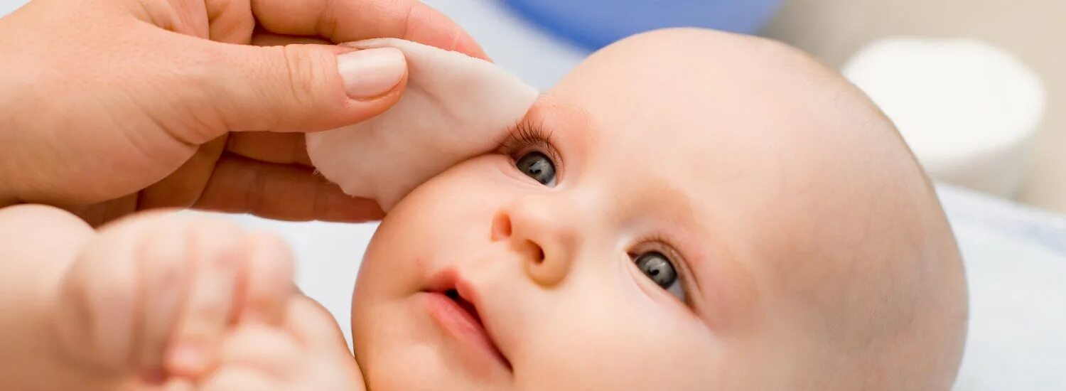 Чем обработать глаза новорожденному. Глаза новорожденного. Обработка глаз у новорожденных. Дакриоцистит новорожденных.