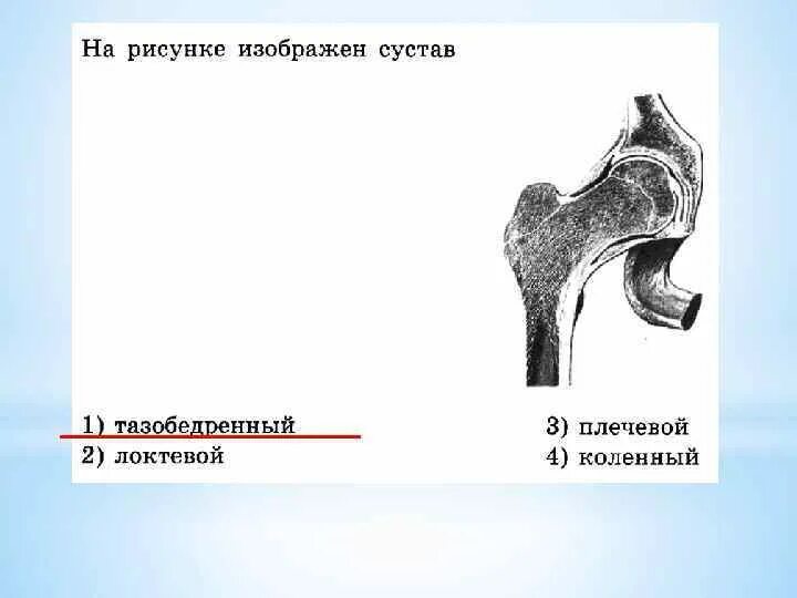 На рисунке изображен сустав. На рисунке изображен сустав