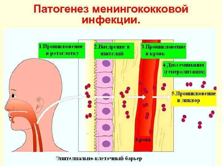 Этиология сыпей. Патогенез менингококкового менингита схема. Менингококковая инфекция патогенез схема. Менингококковая инфекция клиника патогенез диагностика. Этиология патогенез менингококк менингококковая инфекция.