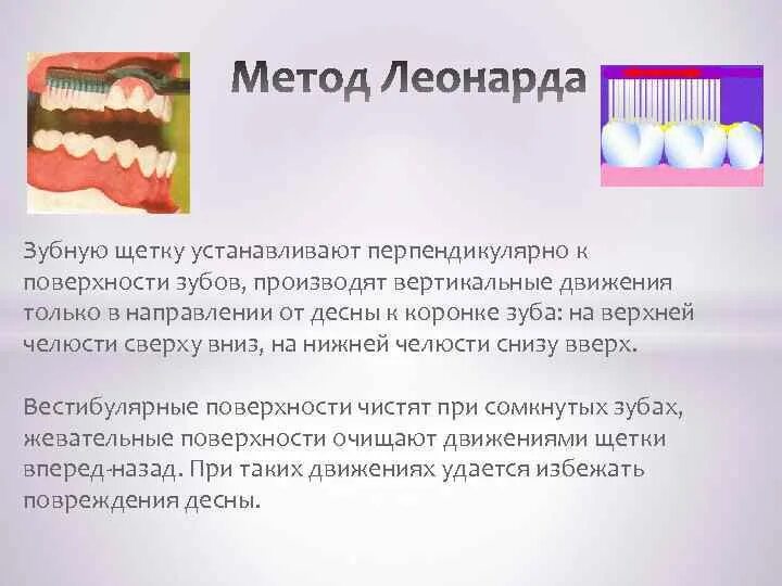 Метод чартера чистки зубов. Метод Леонардо чистки зубов. Метод Leonard чистка зубов.