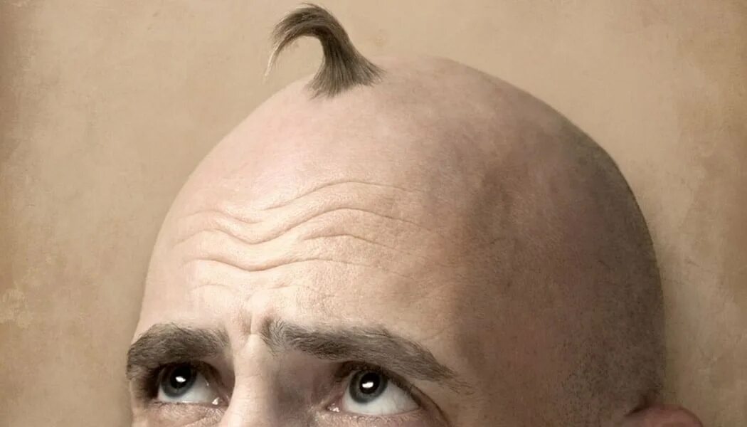 Head hair. Лысые головы. Лысина по середине