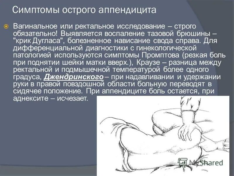 Можно ли назвать травмой аппендицит. Симптомы характерные для аппендицита. Симптомы аппендицита симптом. Симптомы острого аппендицита.