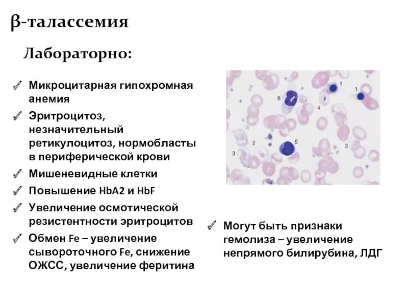 Тромбоцитоз лейкоцитоз. Талассемия гипохромная анемия. Микроцитарная гипохромная Регенераторная анемия. Гипохромная анемия микроцитарная анемия. Гипохромная гипоцентарная анемия.