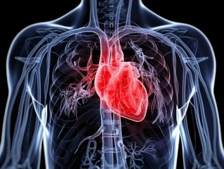 Первичный острый инфаркт миокарда. Заболевания сердечно-сосудистой системы. Сердечно сосудистая система инфаркт миокарда. Инфаркт миокарда. Лечебная физкультура при заболевании ссс.