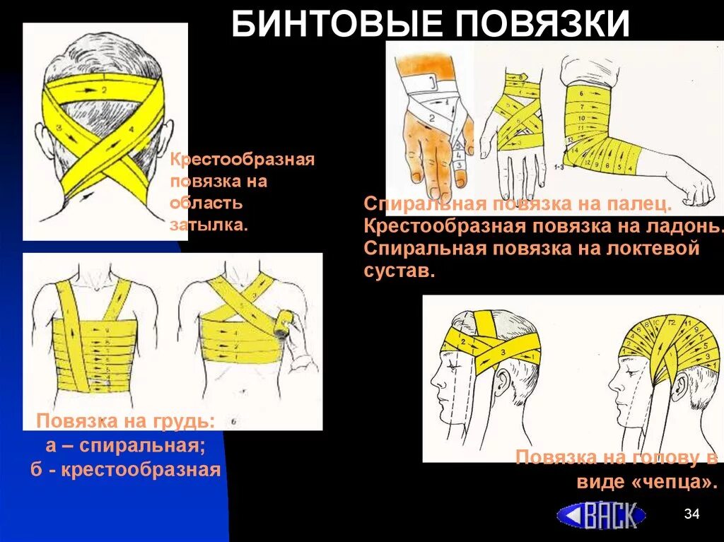 Основные типы повязок. Бинтовые повязки. Типы бинтовых повязок. Бинтовые повязки повязки. Виды наложения повязок.