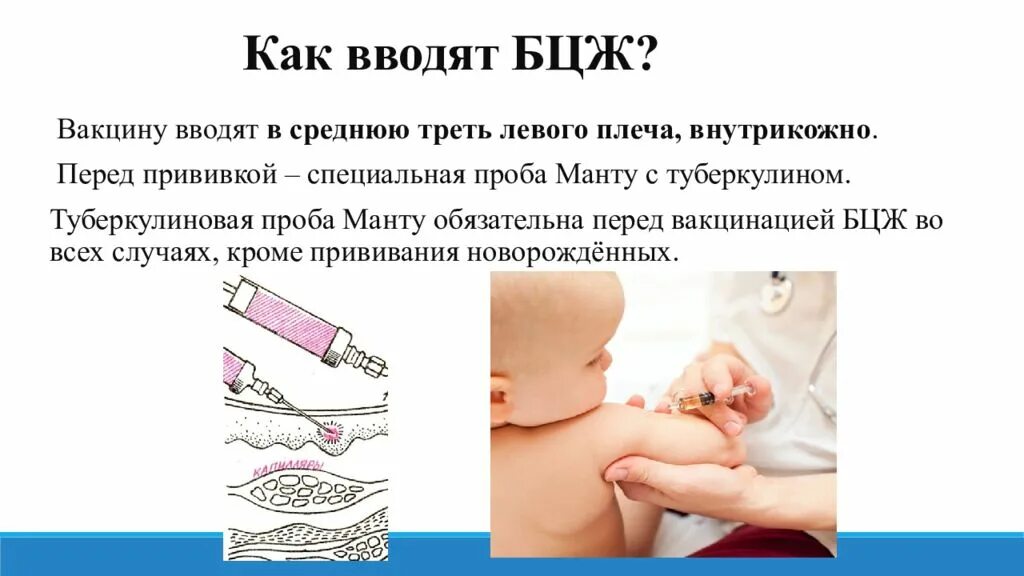 Куда вводится вакцина. Метод введения вакцины БЦЖ. Техника вакцинации БЦЖ-М. Вакцина БЦЖ проводится подкожно.