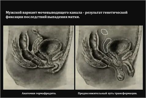 гермафродиты человек их органы: 2 тыс изображений найдено в Яндекс Картинках