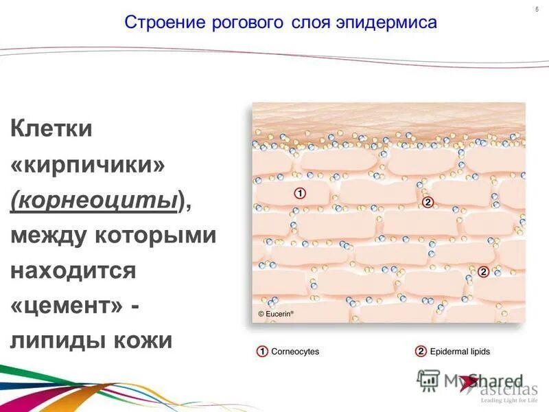 Анаболия девиация архаллаксис. Образование роговых структур. Строение эпидермиса кожи роговой слой. Роговые образования кожи человека. Роговые чешуйки корнеоциты.