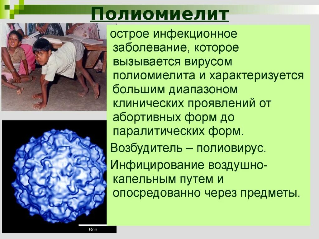Полиомиелит инфекционные болезни. Полиэмилит что за болезнь. Вирус полиомиелита клинические проявления. Полиомиелит проявления болезни. Полиомиелит конечностей.