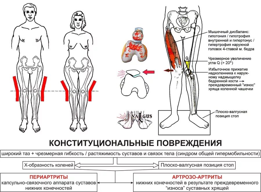 Растяжка мышц сгибателей бедра. Детский массаж при гипертонусе ног до года. Массаж при гипертонусе ножек. Определение мышечного тонуса. Гипертонус нижних конечностей.