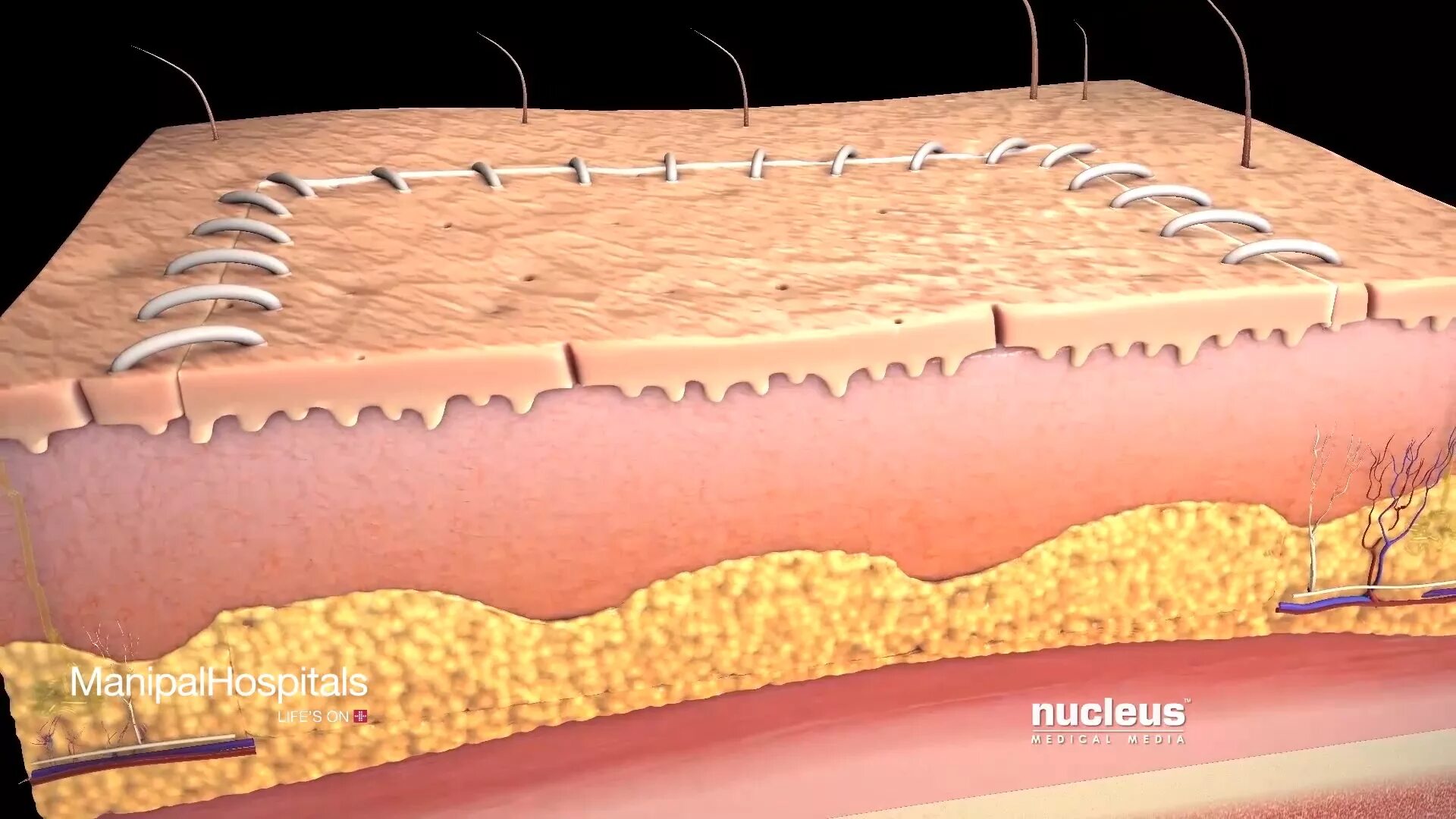 рубцовая ткань кожи. нормотрофический рубец рубец. рубцовая ткань кожи. келоидный рубец структура. рубцовая ткань кожи.