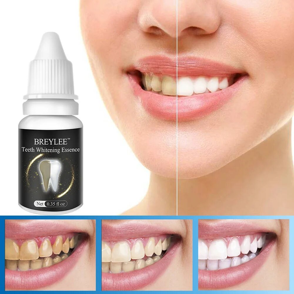 BREYLEE* Teeth Whitening Essence 250. Средство для отбеливания зубов LANBENA. Отбеливание зубов Teeth Whitening Essence. BREYLEE отбеливание зубов.