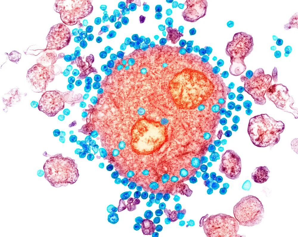 Вирус СПИДА на белом фоне. HIV. B lymphocytes HIV. Human immunodeficiency virus 1