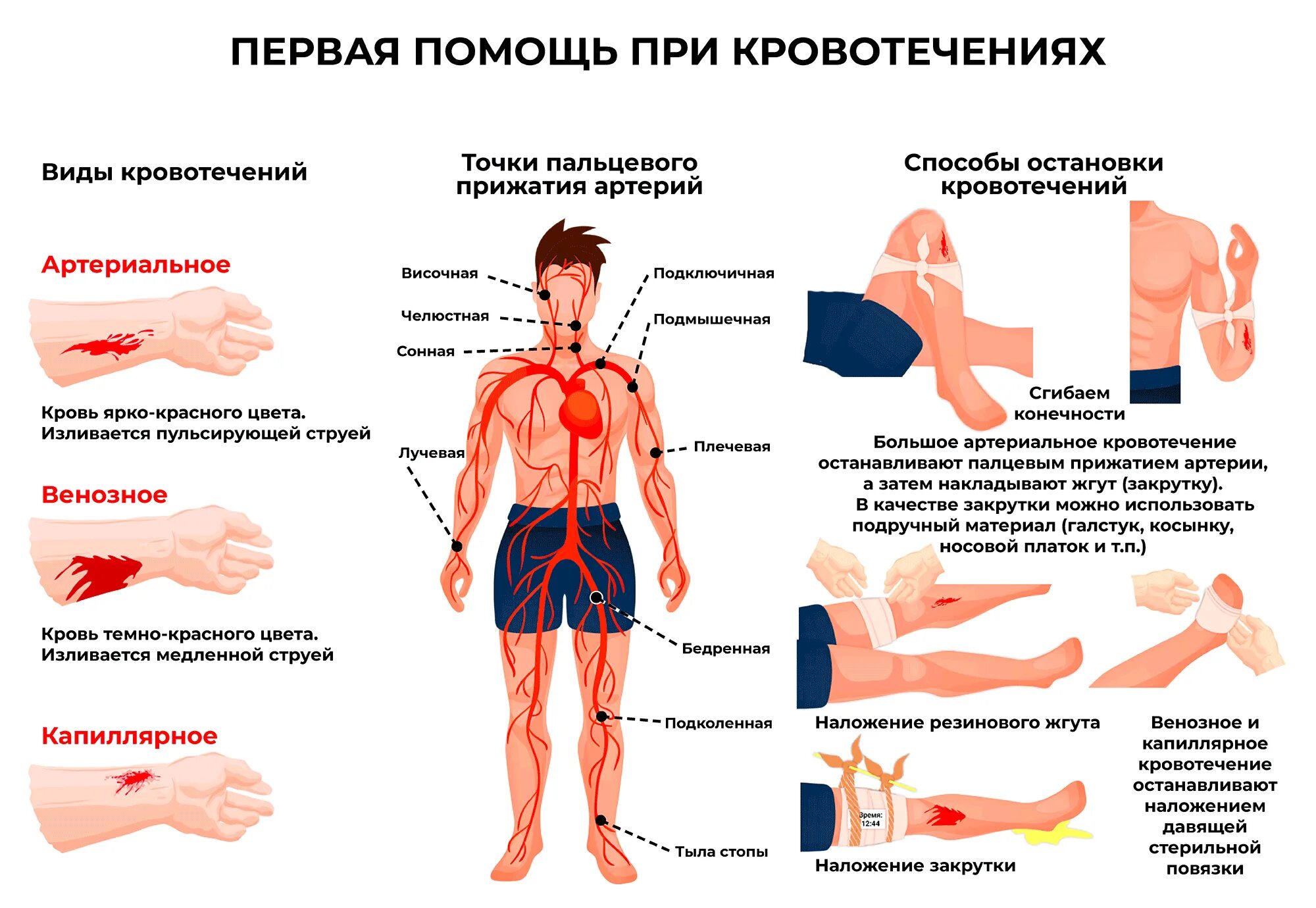 Типы и первая помощь при кровотечении. Принципы первой помощи при кровотечении. Памятка оказания первой помощи при наружном кровотечении. Последовательность первой помощи при наружном кровотечении. Повреждение мелких артерий кистей и стоп