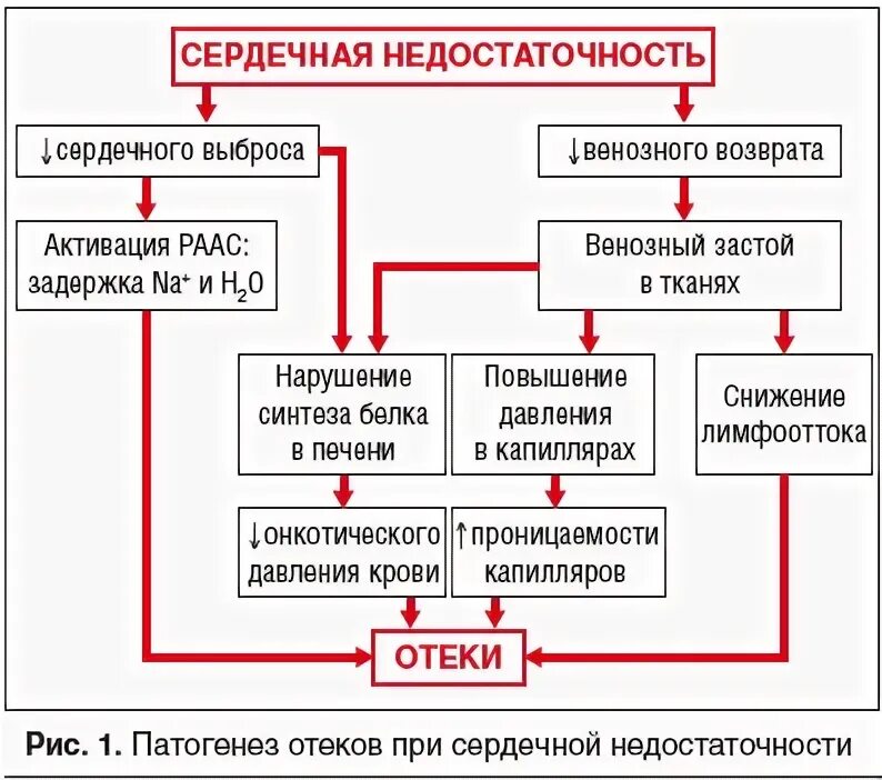 Сердечный отек симптомы. Механизм развития отеков при сердечной недостаточности. механизм развития отеков при хсн. патогенез отечного синдрома при сердечной недостаточности. отеки при сердечной недостаточности патогенез.