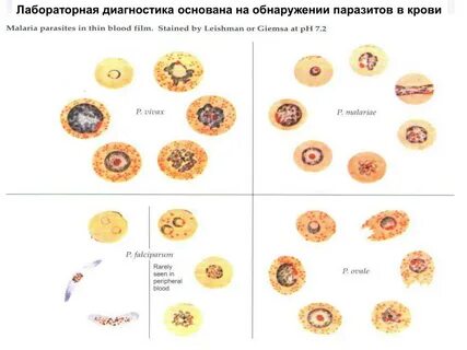 Распознать паразитов