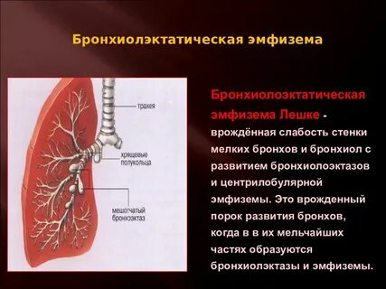Развитие бронхов