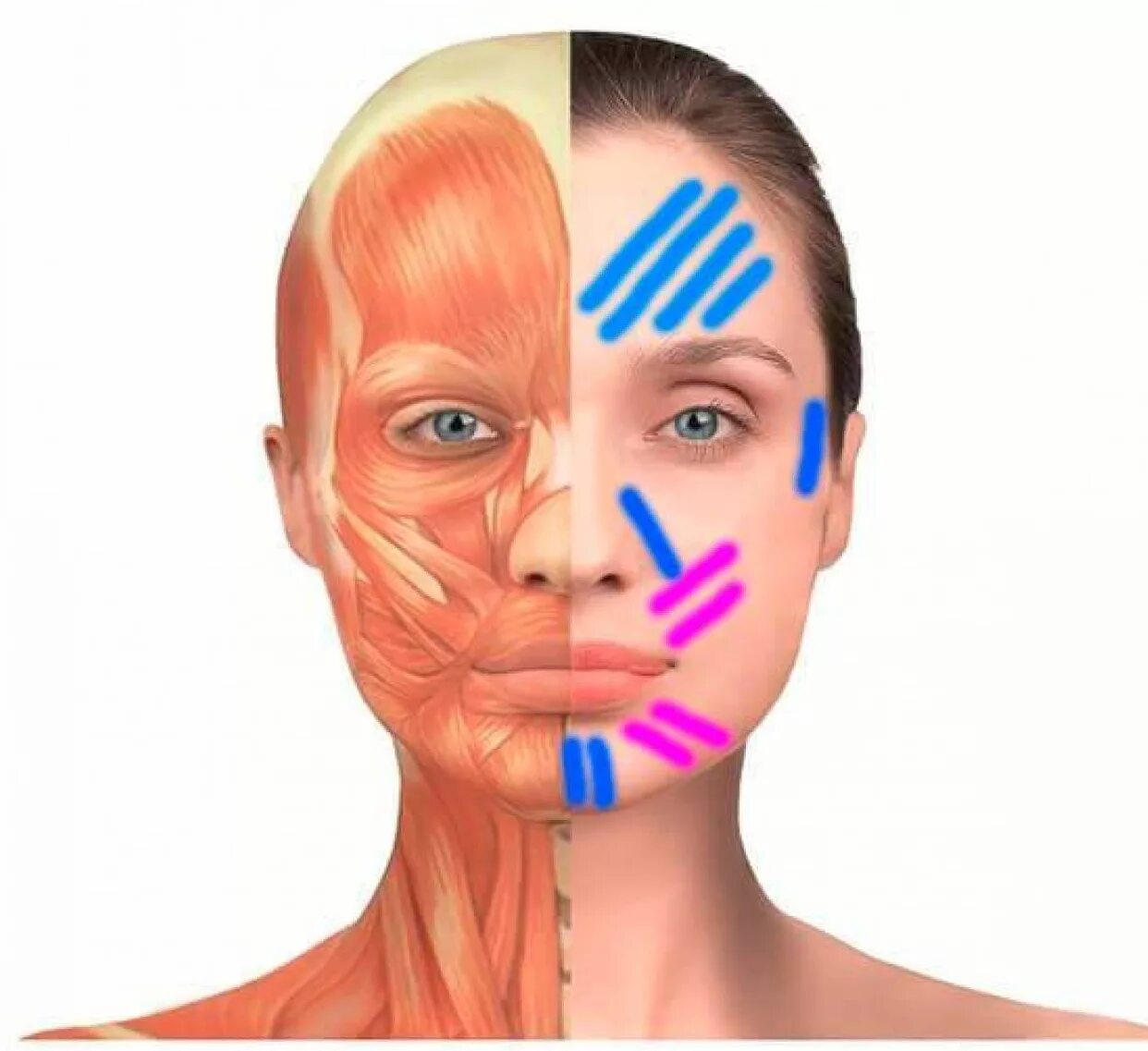 Косметология мышцы. Тейпирование межбровной морщины. Тейпирование кисетных морщин. Тейпирование межбровной складки. Носогубка в тейпирование.