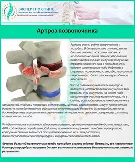 Артроз реберно позвоночных лечение