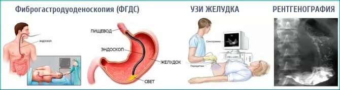 Язвенная болезнь желудка ФГДС. Язвенная болезнь ДПК ФГДС. Двенадцатиперстная кишка ФГДС.