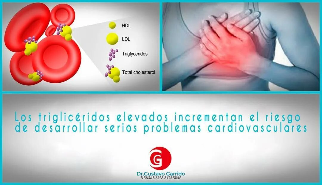 Qué significa tener los triglicéridos altos