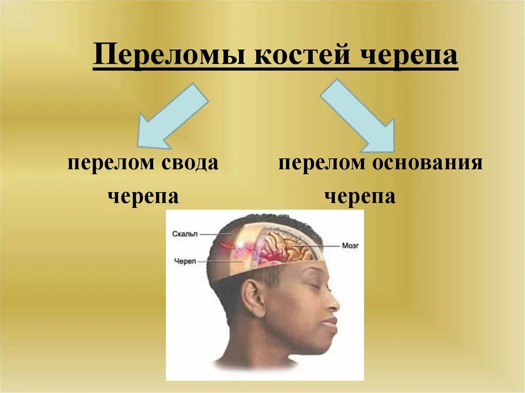 Перелом кости свода черепа. Перелом свода основания черепа. Перелом костей свода черепа. Перелом костей свода и основания черепа.