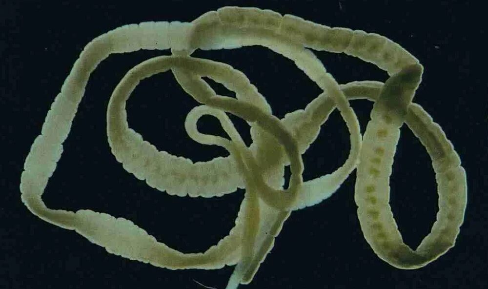Болезни гельминтозы. Ленточные черви широкий лентец. Ленточный червь лентец. Широкий лентец дифиллоботриоз.