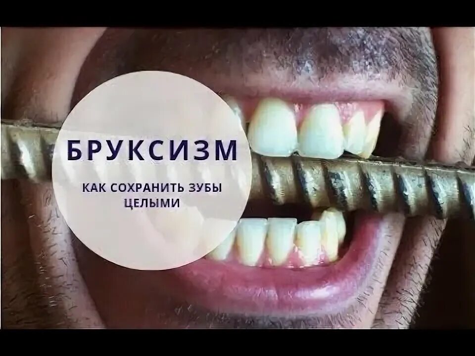 Почему ночью скрежет зубами. Скрипение зубами во сне.
