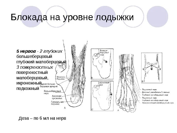 Блокада голеностопного сустава. Проводниковая анестезия большеберцового нерва. Проводниковая анестезия стопы методика. Блокада большеберцового нерва. Блокада большеберцового нерва техника.