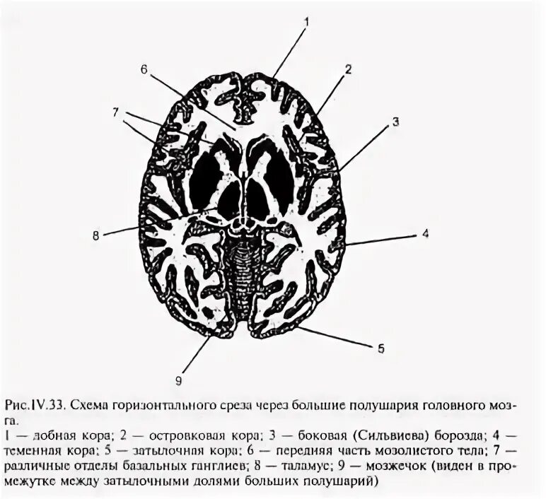 Вазогенный очаг больших полушарий. Горизонтальный разрез головного мозга. Горизонтальный срез полушарий головного мозга. Строение головного мозга в горизонтальном разрезе. Строение больших полушарий на поперечном срезе.