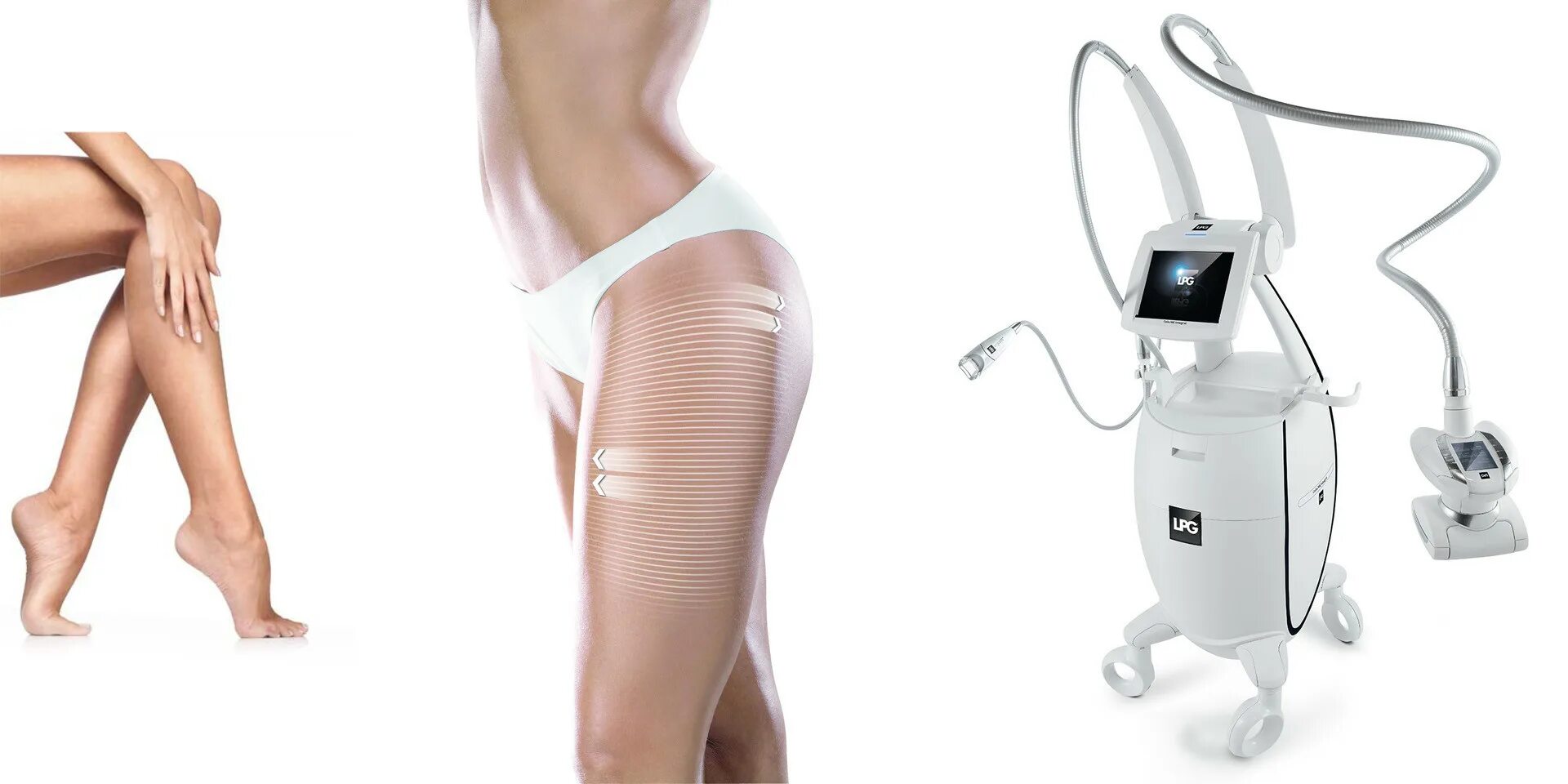 Аппарат LPG Cellu m6 integral. LPG Cellu m6 integral. LPG Cellu m6 Alliance. LPG Endermologie аппарат. Эффективное аппаратное похудение