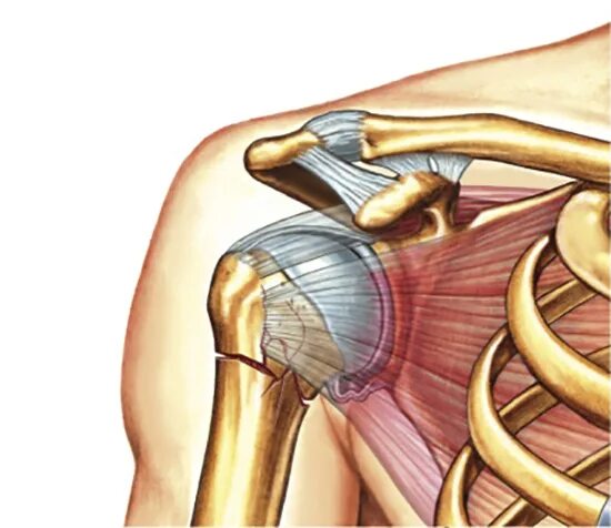 Перелом плечевого сустава. Пеиелом плеяеыоно Сусию. Перелом ключевого сустава. Повреждения правого плечевого сустава