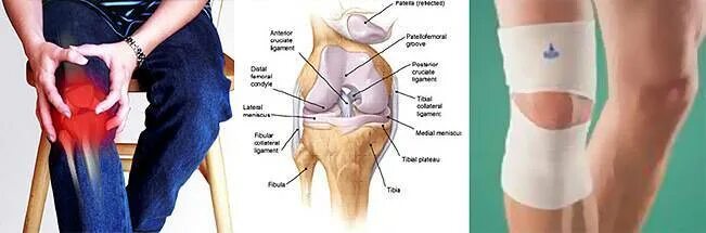 Болит под коленкой. Внутренняя сторона колена. Болит колено с внутренней стороны. Внутренняя сторона коленного сустава. Болит колено при сгибании с внутренней стороны.