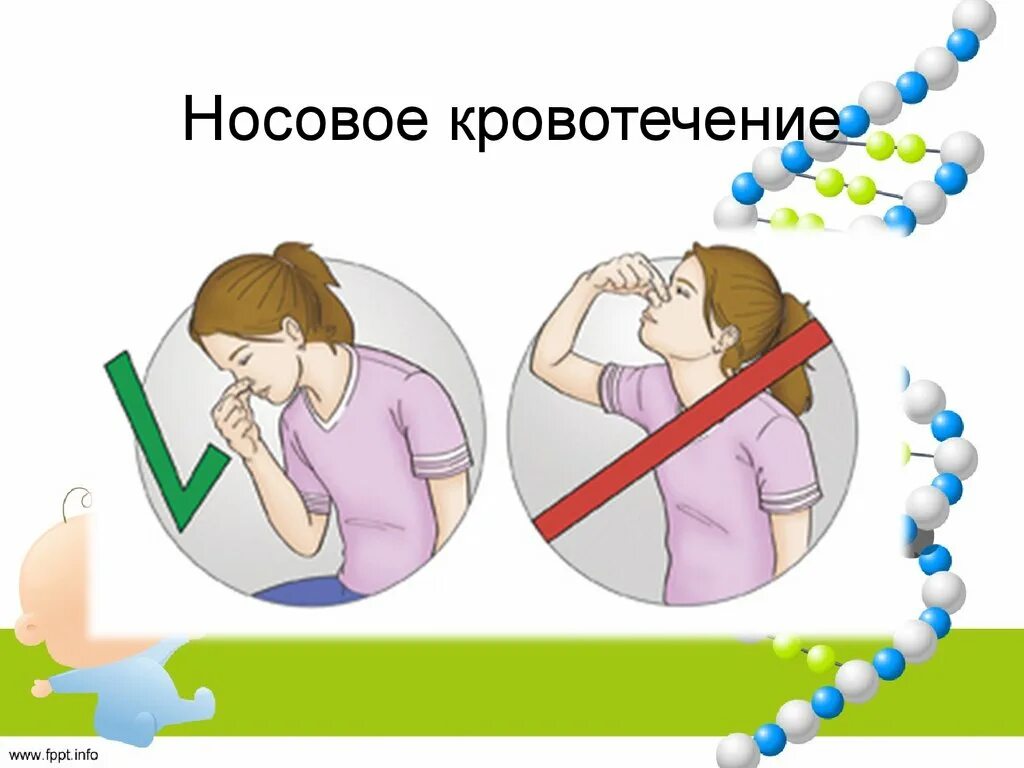 Носовые кровотечения рекомендации. Носовое кровотечение рисунок. При кровотечении из носа. Первая помощь при носовом кровотечении плакат.