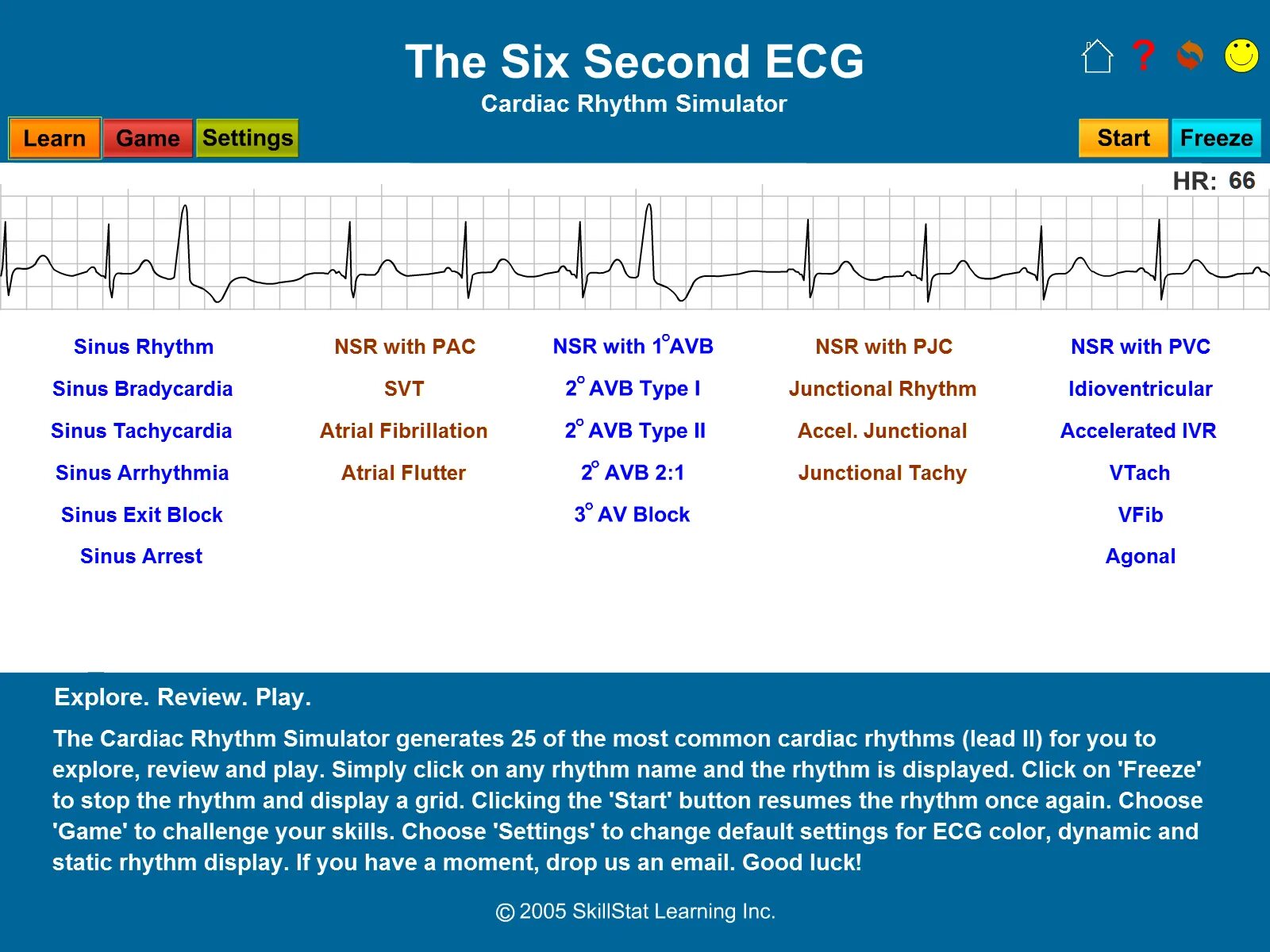 Six second. Extra Beat ECG. Pac ECG. ЭКГ. ECG game.