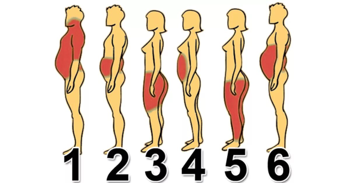 Типы ожирения. Типы отложения жира. Типы отложения жира у женщин. Типы жироотложения у женщин.