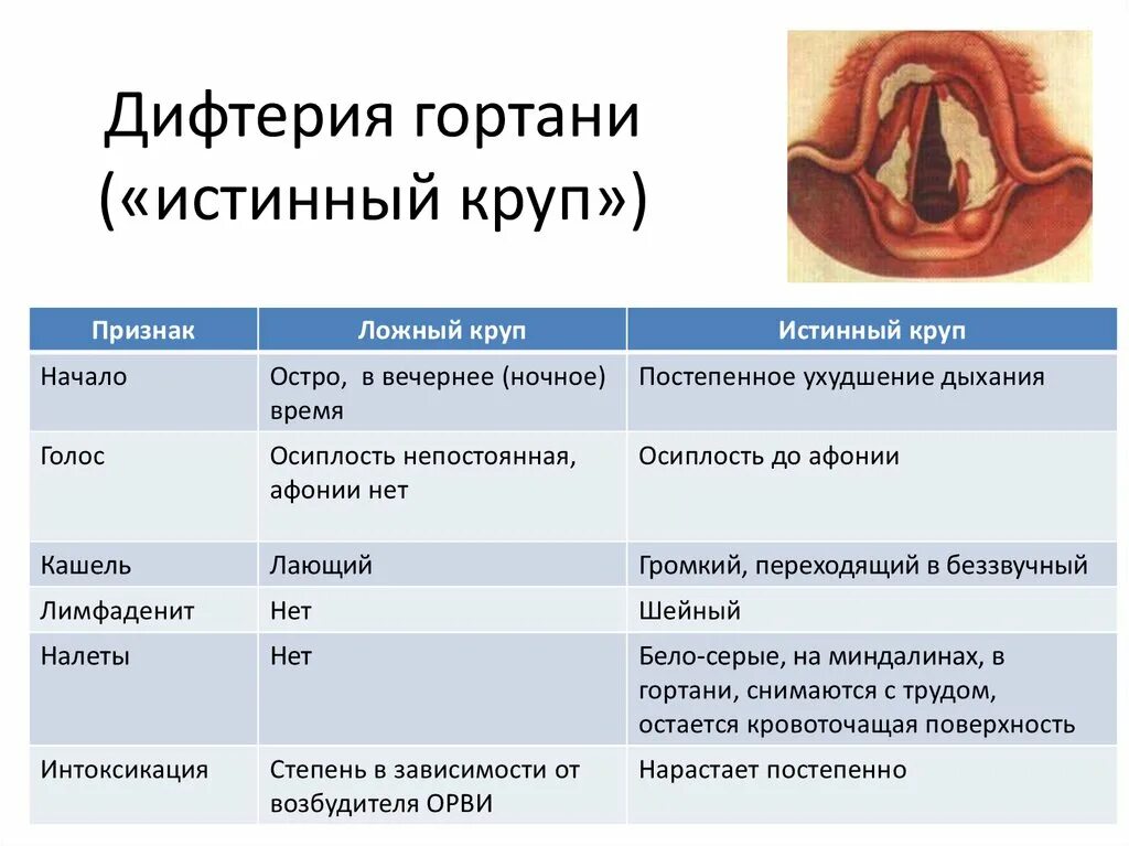 Возбудители острого катарального ларингита. Дифтерия гортани пленка. Дифтерия гортани клиника стадии. Круп при дифтерии гортани характеризуется.