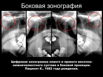 Зонография