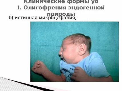 Синдром гипервозбудимости у новорожденных