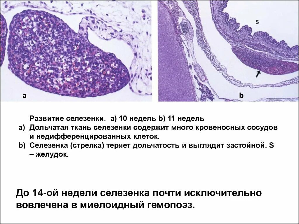 Селезенка микропрепарат гистология. Селезенка гистология препарат. Белая пульпа селезенки гистология. Источник развития селезенки гистология.