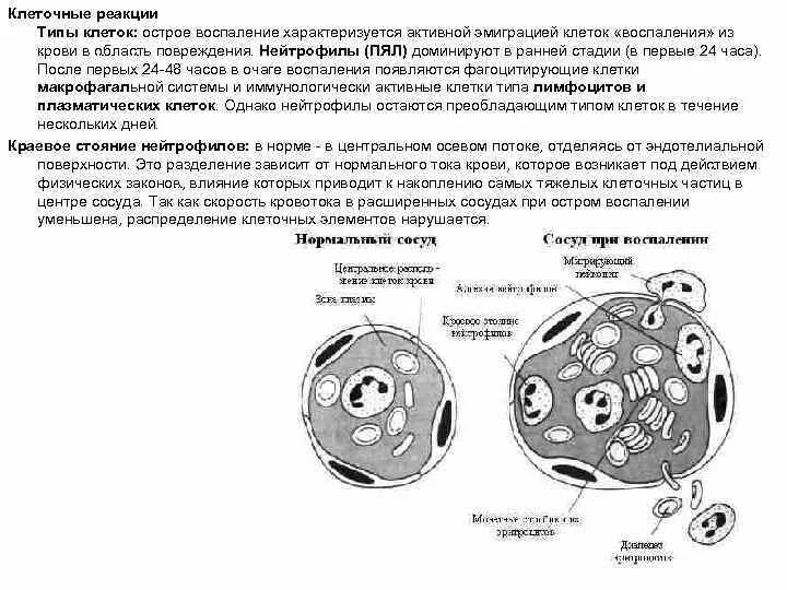 Клетки воспалительной реакции. Клетки воспалительной реакции
